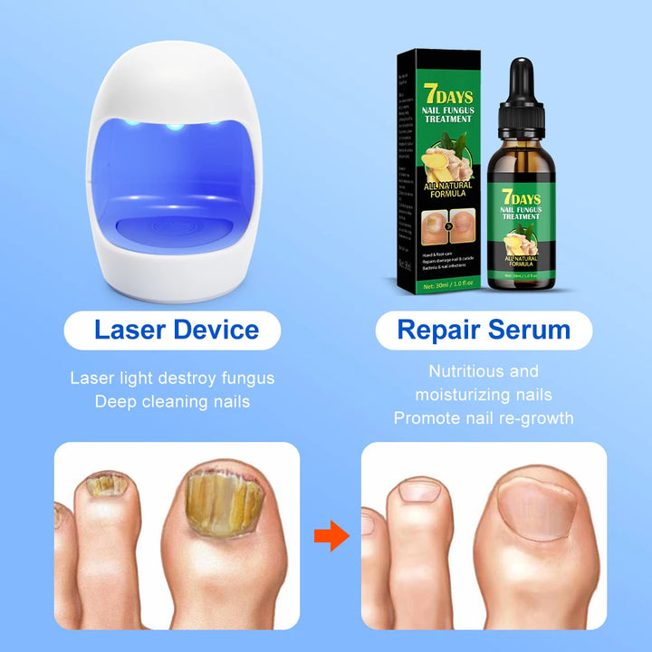 Toenail Nail Fungus Treatment Repair Fingernail Device Toenail Treatment for Foot Nail Fungus Essential Oil Onychomycosis Care